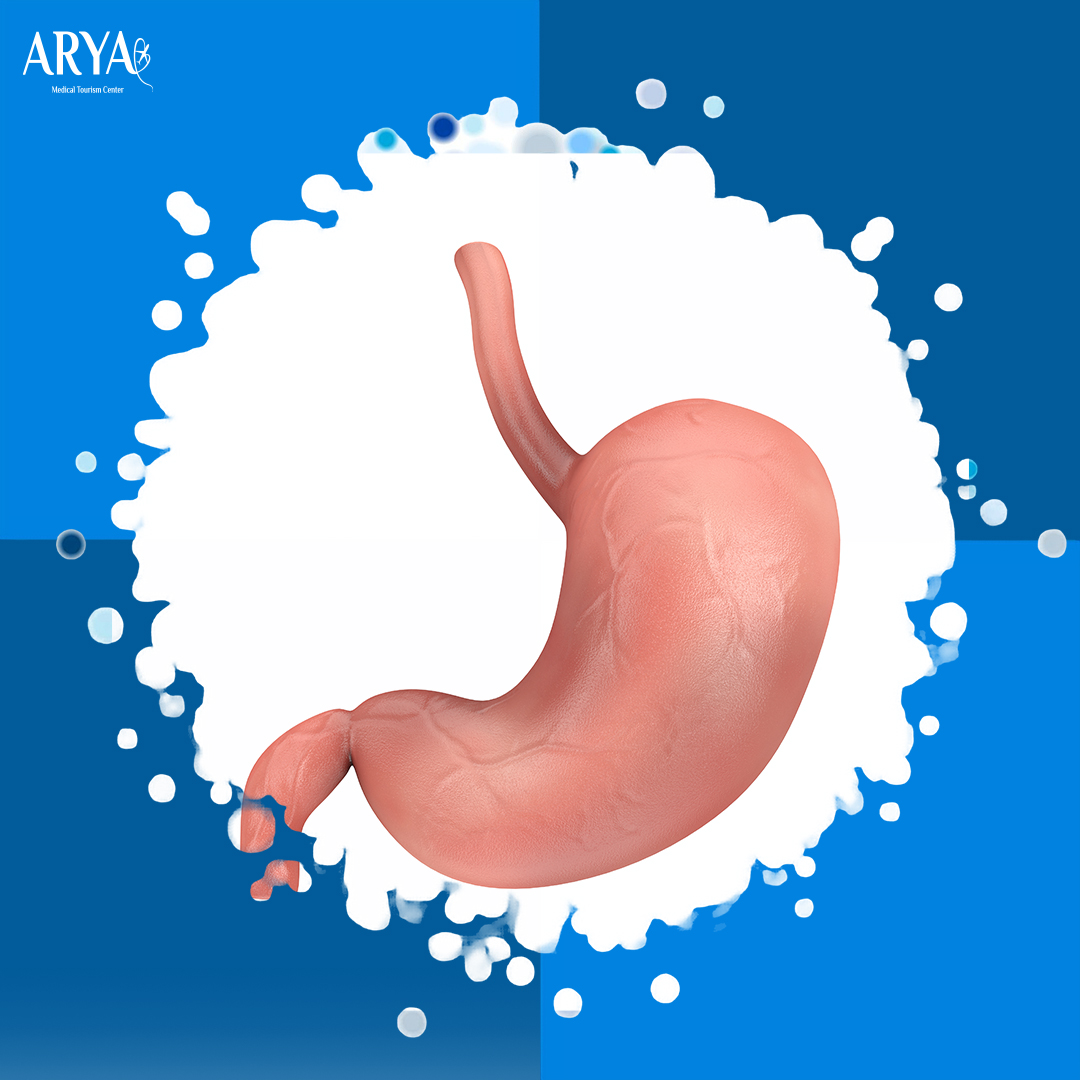 كبسولة المعدة